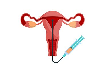 Best Fertility Clinic India