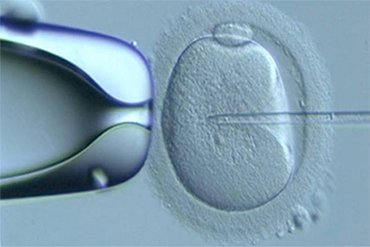 Best IVF Treatment in India