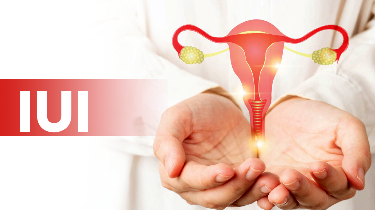 Best IUI Clinic in Delhi