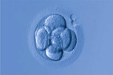 Best IVF Clinic in India